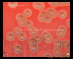 streptococcus equi